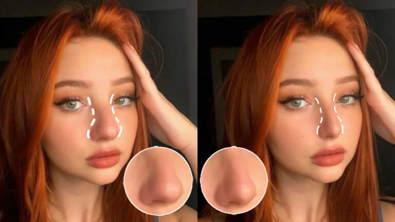 هوش مصنوعی عمل بینی BeautyPlus
